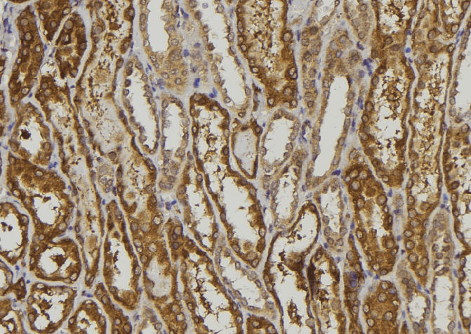 CEAL2 / CEACAM16 Antibody
