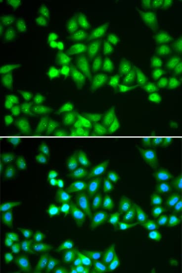 CHD2 Antibody