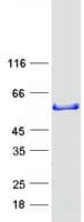 Human SNX16 Protein (Recombinant Myc-DDK (Flag))