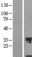 SCGB1A1 / Uteroglobin Protein (Over-Expression Lysate Myc-DDK (Flag))