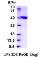 Human ZADH2 Protein (Recombinant His)