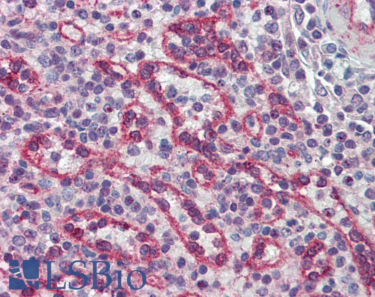 IHC-plus™ IRAK2 / IRAK-2 Antibody (clone 6C7)