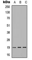 IMMP1L Antibody (Internal)
