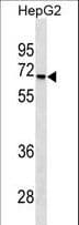 STK39 / SPAK Antibody