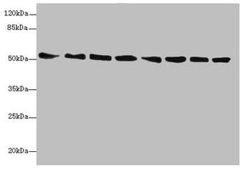 PDIA6 / ERP5 Antibody