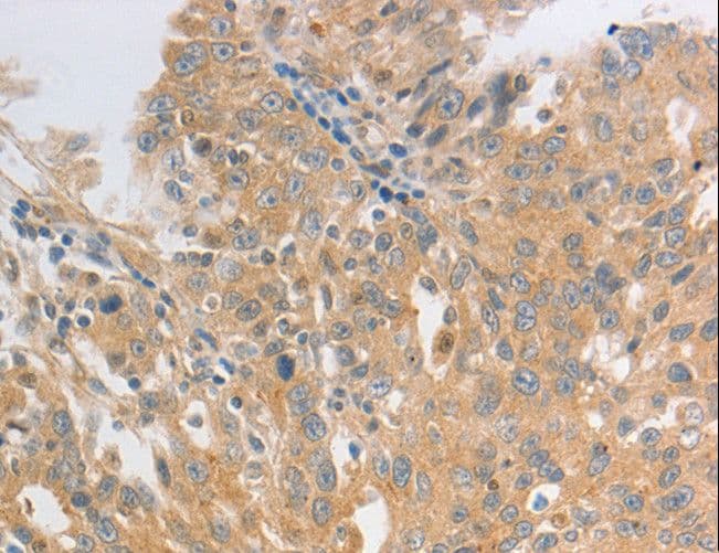 OX2R / Orexin Receptor 2 Antibody