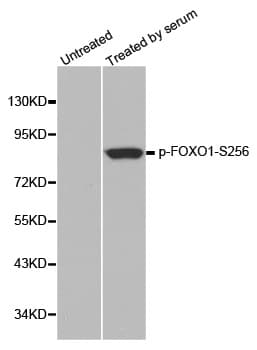Polyclonal Rabbit anti-Human FOXO1 / FKHR Antibody (phospho-Ser256, WB)