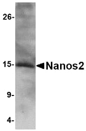 NANOS2 / NOS2 Antibody