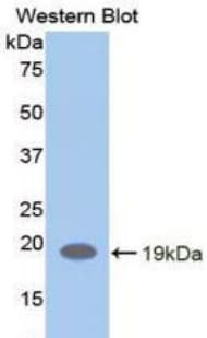 CD118 / LIF Receptor Alpha Antibody (aa692-833, Biotin)