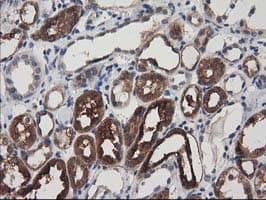 ADSL / Adenylosuccinate Lyase Antibody (clone OTI2D10)