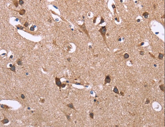 SERPINA1 / Alpha 1 Antitrypsin Antibody