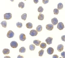 NAK / TBK1 Antibody