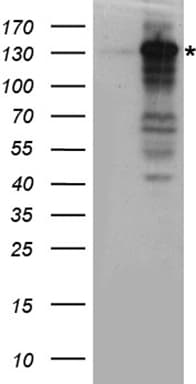 Polyclonal Rabbit anti-Human XPC Antibody (WB)