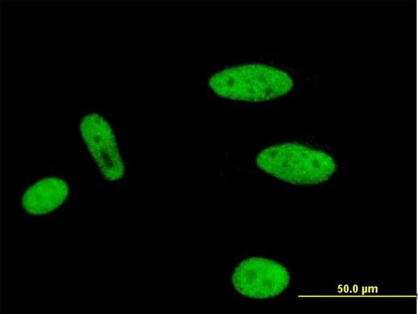 Monoclonal Mouse anti-Human ENL / MLLT1 Antibody (clone 3H2, IF, WB)