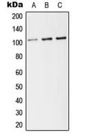 IHC-plus™ THBD / CD141 / Thrombomodulin Antibody (C-Terminus)