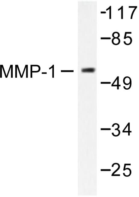 MMP1 Antibody (His440)