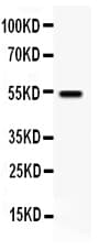 VIPR1 Antibody (aa400-414)