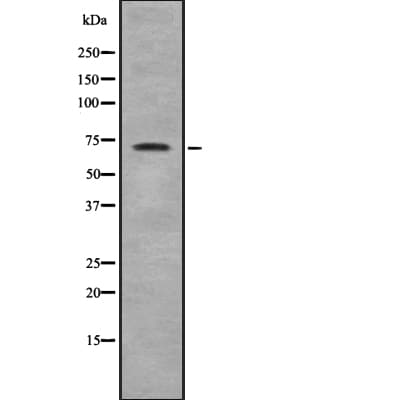Polyclonal Rabbit anti-Human ZNF23 Antibody (IF, WB)