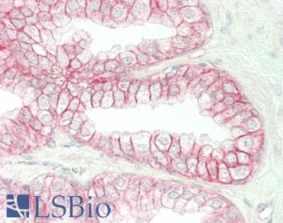 IHC-plus™ CTNNB1 / Beta Catenin Antibody