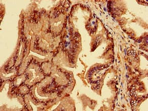 EPN3 Antibody