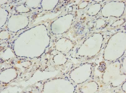 Polyclonal Rabbit anti-Human C11orf68 Antibody (IHC, WB)