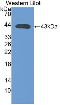 Complement C4 Antibody (aa975-1336)