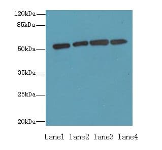 ETNK1 / Ethanolamine Kinase 2 Antibody
