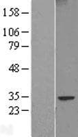 FAM124B Protein (Over-Expression Lysate Myc-DDK (Flag))