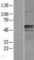 CNDP1 Protein (Over-Expression Lysate Myc-DDK (Flag))