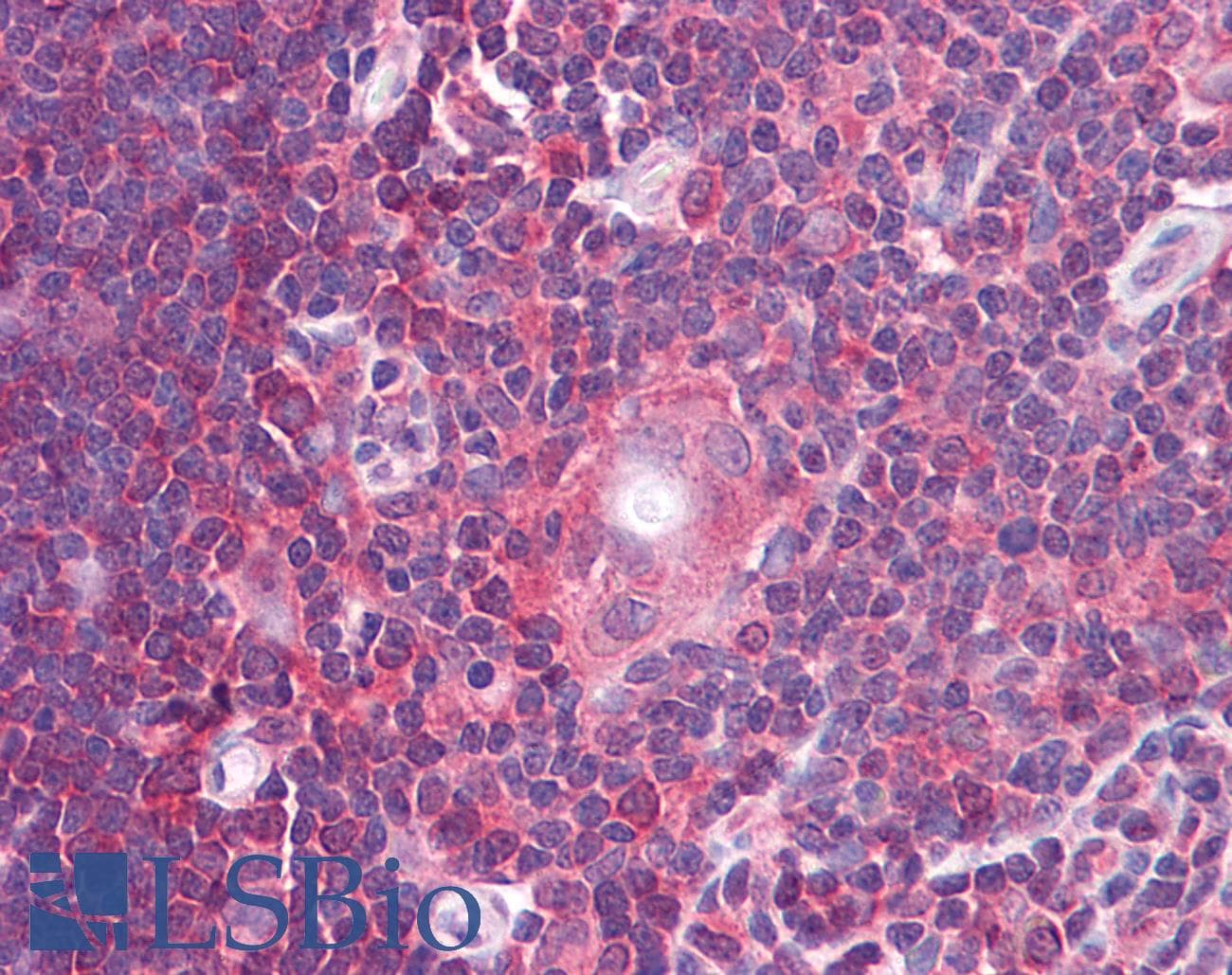 IHC-plus™ Polyclonal Rabbit anti-Human SIP1 Antibody (IHC, IF, WB)