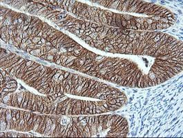 ERBB2 / HER2 Antibody (aa676-1255, clone OTI5F6, Carrier-free)