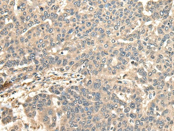 CCDC113 Antibody