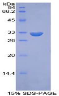 Mouse PIKFYVE / PIP5K Protein (Recombinant His-T7)