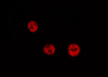 Polyclonal Rabbit anti-Human RELA / NFKB p65 Antibody (Acetyl-Lys310, IHC, IF, WB)