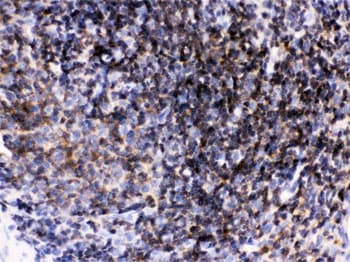 Polyclonal Rabbit anti-Human p56lck / LCK Antibody (IHC, WB)
