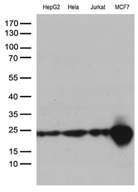 MGMT Antibody (clone OTI2E2)