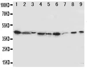 Polyclonal Rabbit anti-Human IDO1 / IDO Antibody (aa1-20, WB)