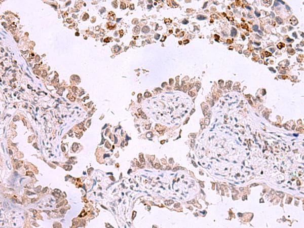 Polyclonal Rabbit anti-Human ITPKC Antibody (IHC)