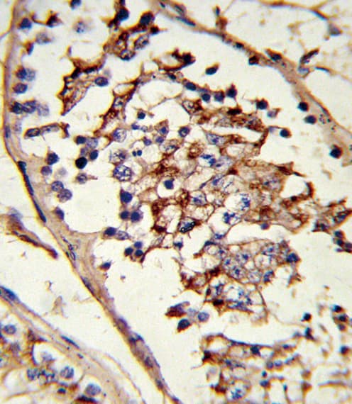 Polyclonal Rabbit anti-Human GLUL / Glutamine Synthetase Antibody (aa70-96, IHC, WB)