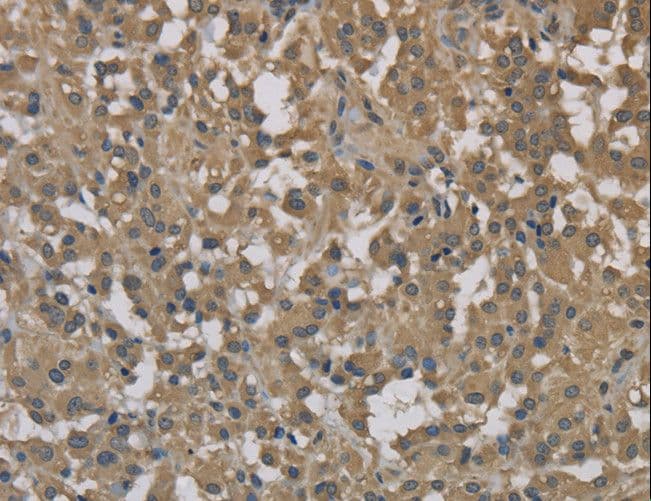 Dynactin 3 / DCTN3 Antibody