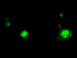 RPA2 / RFA2 / RPA34 Antibody (clone OTI4C3)