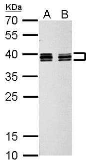 HNRNPC / HNRNP C Antibody (aa1-142)