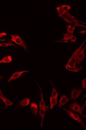 GPR180 Antibody