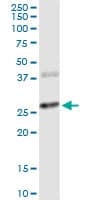 CTLA4 / CD152 Antibody (clone 2F1)