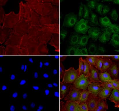 Monoclonal Mouse anti-Human BUB1B / BubR1 Antibody (clone UMAB7, IHC, IF, WB)