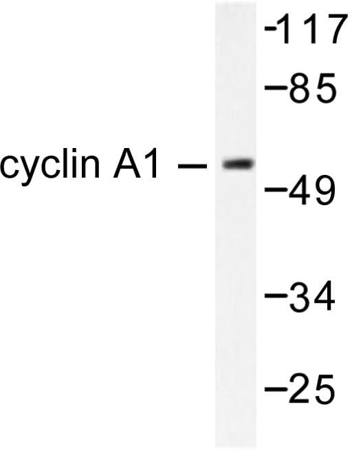 Polyclonal Rabbit anti-Human CCNA1 / Cyclin A1 Antibody (Arg436, IHC, WB)
