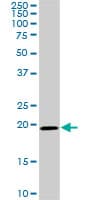 SRI / Sorcin Antibody (clone 1E12)