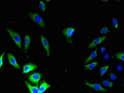 Polyclonal Rabbit anti-Human GJB5 / CX30.1 / Connexin 31.1 Antibody (aa211-273, IHC)