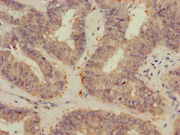 VEGFB Antibody