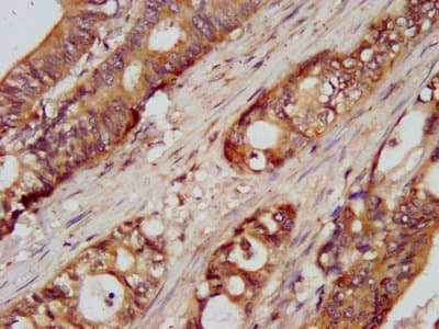 UMPS / OPRT Antibody